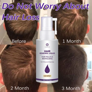 Спрей за растежа на косата за мъже и жени, средство против косопад, масло за бързо прераждане на косата, питающее кожата на главата, здраве и красота, 30 мл