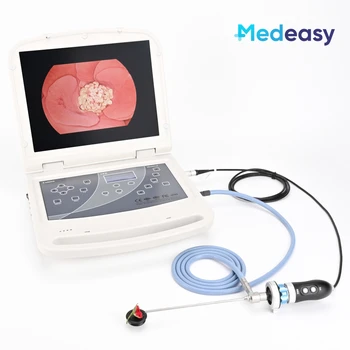 Медицинска система ендоскопска камера, 3 в 1 с 15.6-инчов монитор, 60 Watt led източник на светлина и USB-запис на
